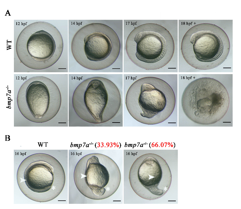 ▲野生型和bmp7a-/-突变体胚胎中的纯合致死表型观察