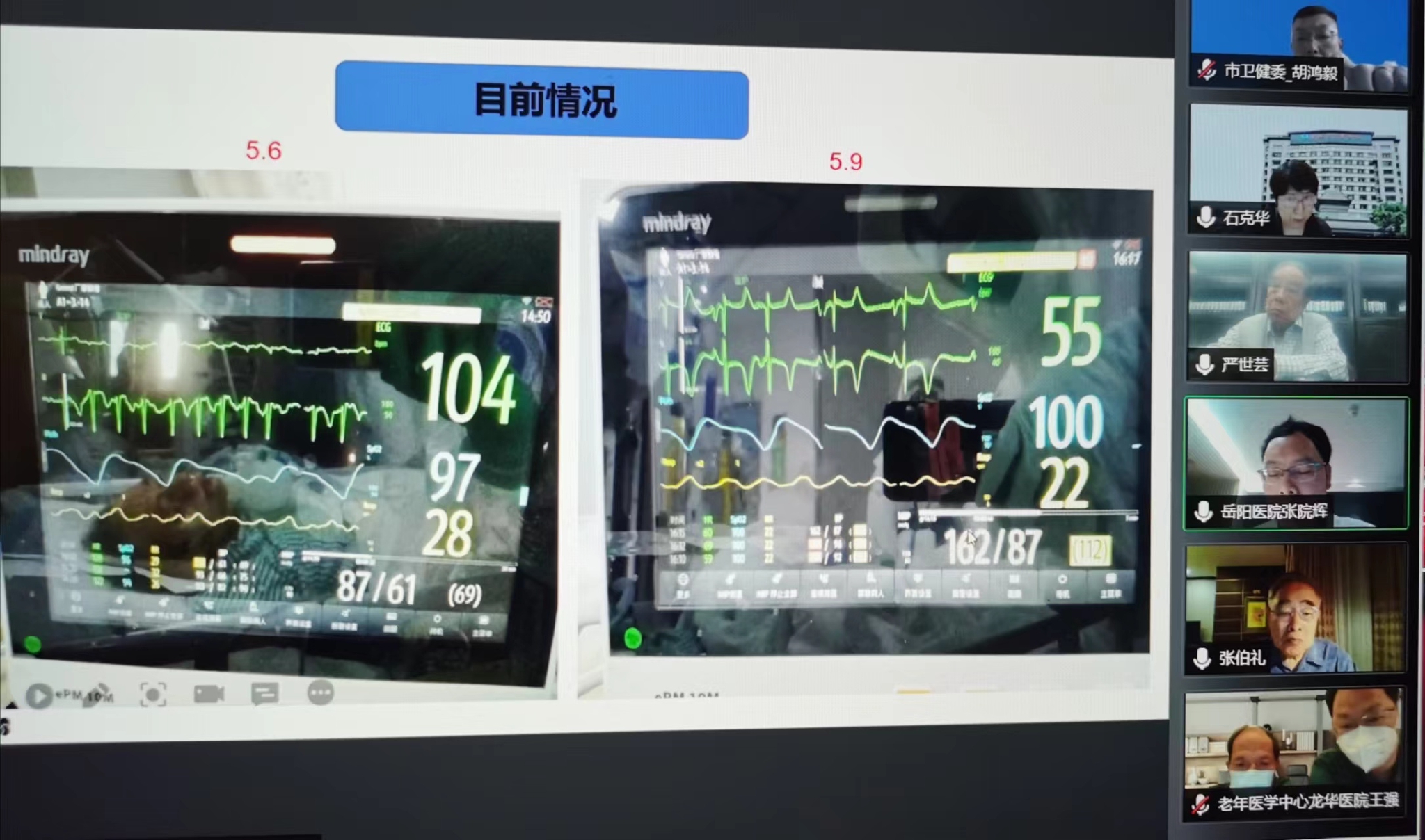 曙光医院、湖南援沪医疗队专家通过视频连线，与张伯礼、严世芸等专家共同讨论病例中西医协同救治。上海市中医药管理局 供图